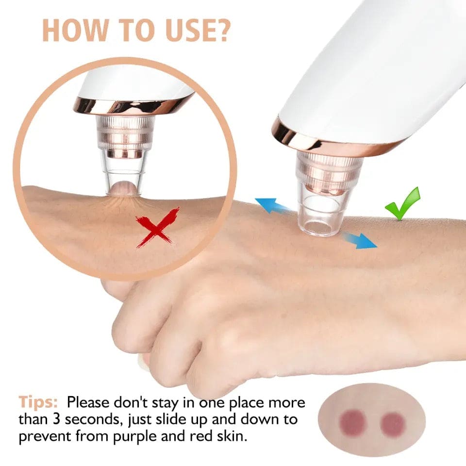 Electric Blackhead Remover, Vacuum Acne Cleane